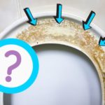 What Causes Yellow Stains on Toilet Seats?